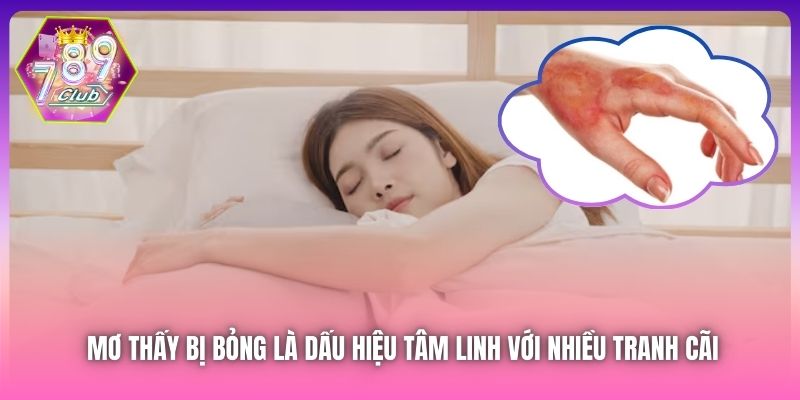Mơ thấy bị bỏng là dấu hiệu tâm linh với nhiều tranh cãi